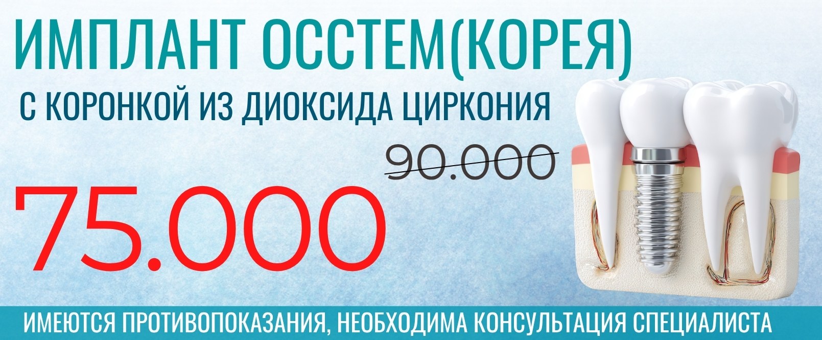 Акция стоматологии МегаДент