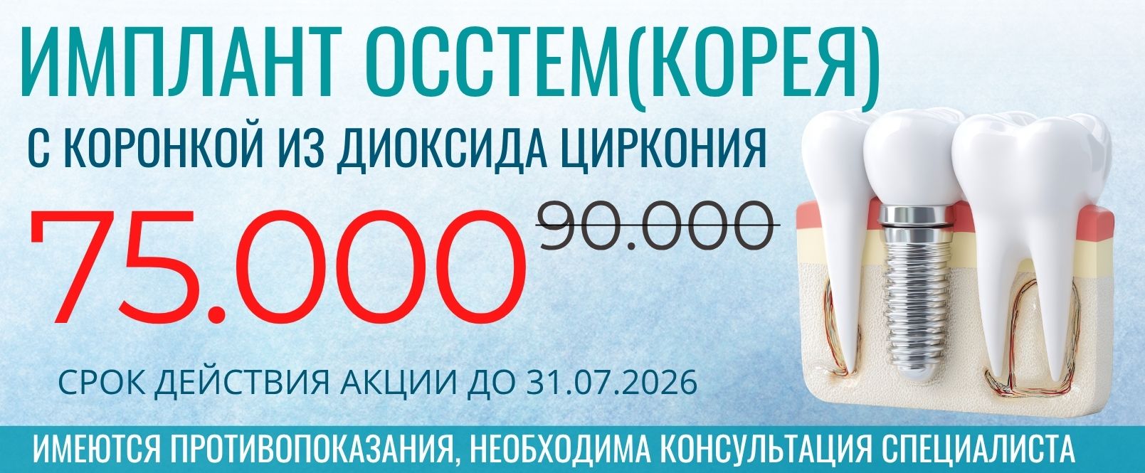 Акция стоматологии МегаДент