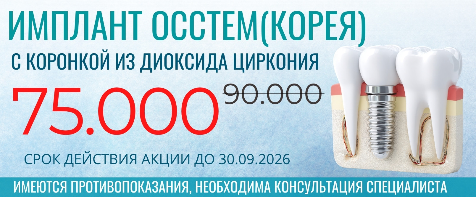 Акция стоматологии МегаДент
